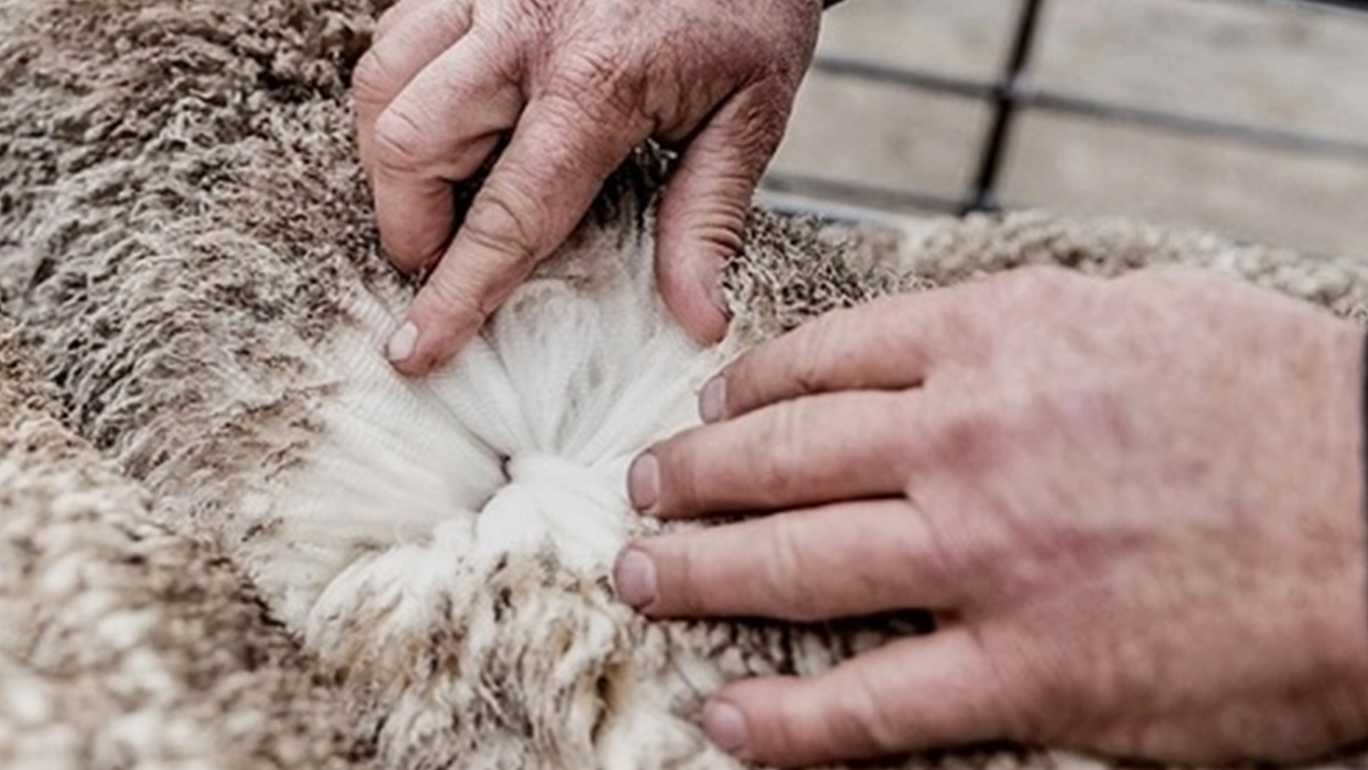 طبیبی به نام پشم